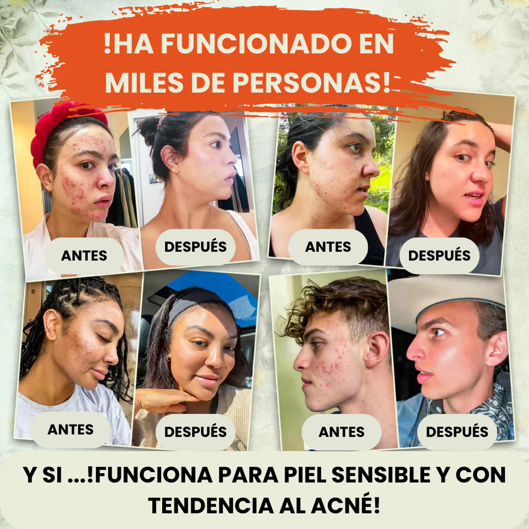 EVIL GOODS - SEBO DE RES: La Crema Exclusiva que Cambiará tu Piel